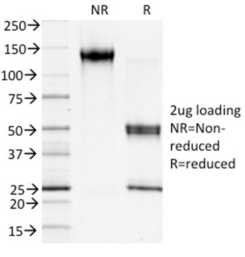 Data from SDS-PAGE analysis of Anti-S100A4 antibody (Clone S100A4/1481). Reducing lane (R) shows heavy and light chain fragments. NR lane shows intact antibody with expected MW of approximately 150 kDa. The data are consistent with a high purity, intact mAb.